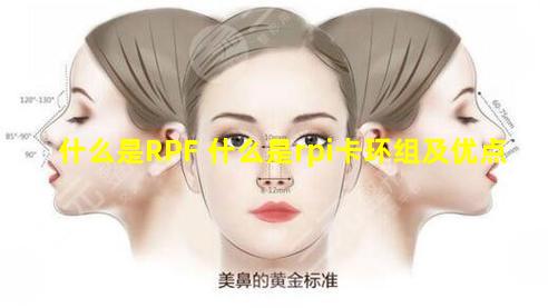 什么是RPF 什么是rpi卡环组及优点